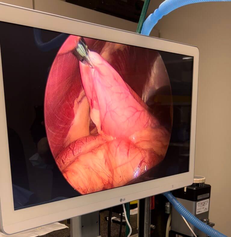 Monitor displaying laparoscopic surgery of a pet
